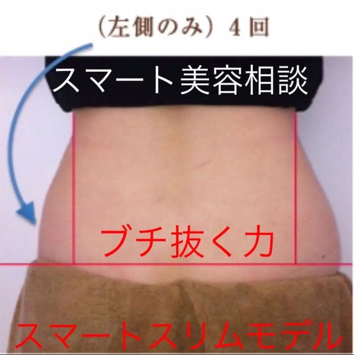 美容機器 キャビテーション 2in1 ラジオ波 リフトアップマシン 業務用