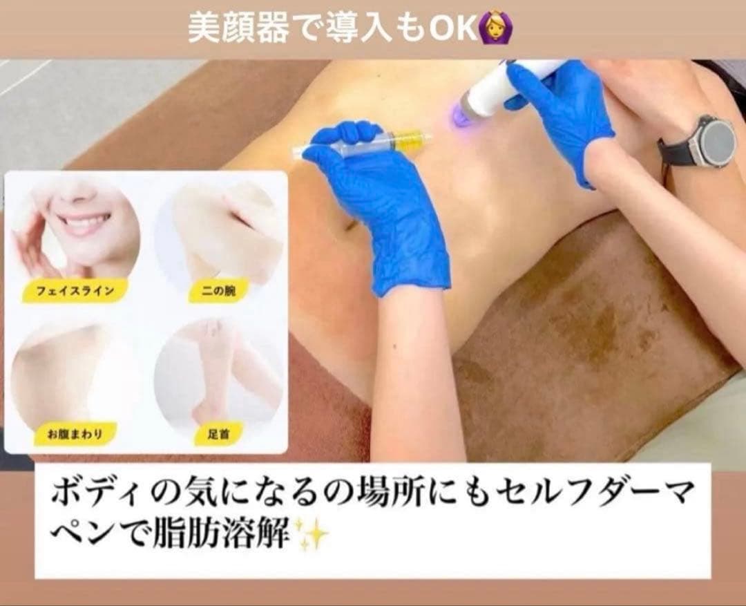 くじら　レモンボトル×3本