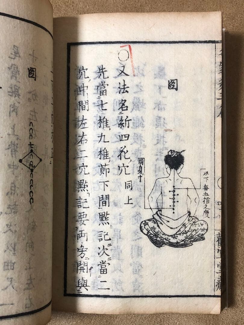 名家灸選三編 古文書 和本（医学書/医学史）