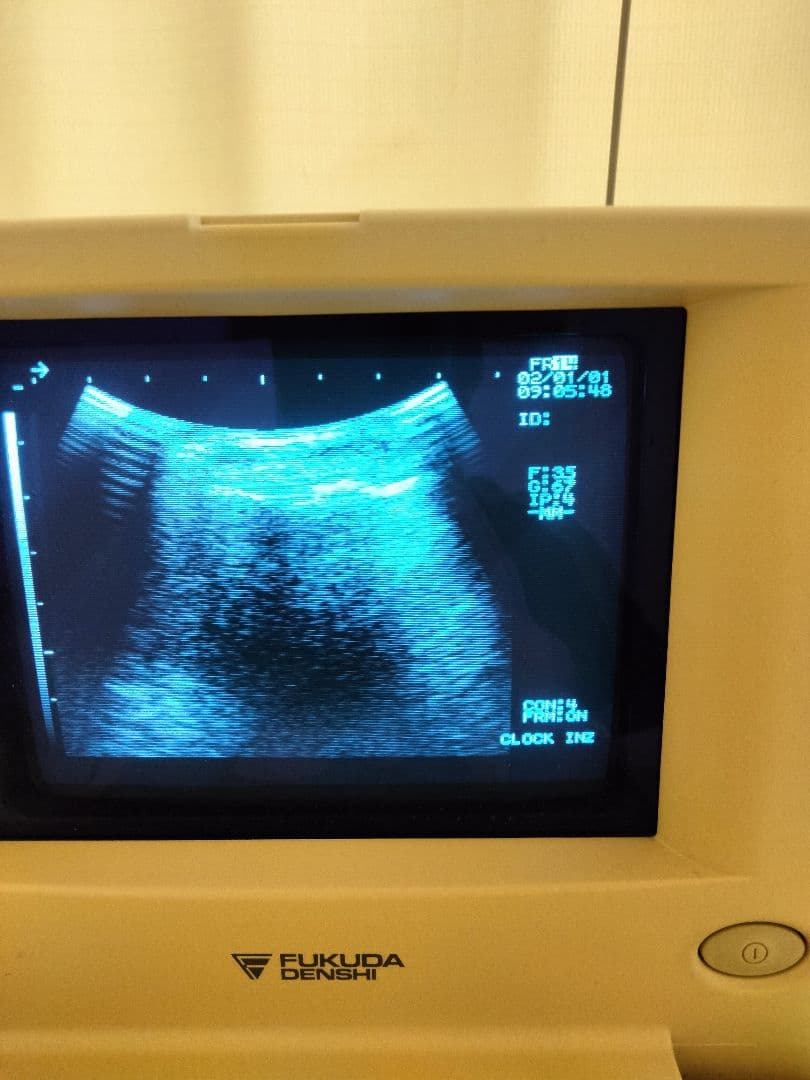 超音波　画像診断　エコー　フクダ電子UF-4100M