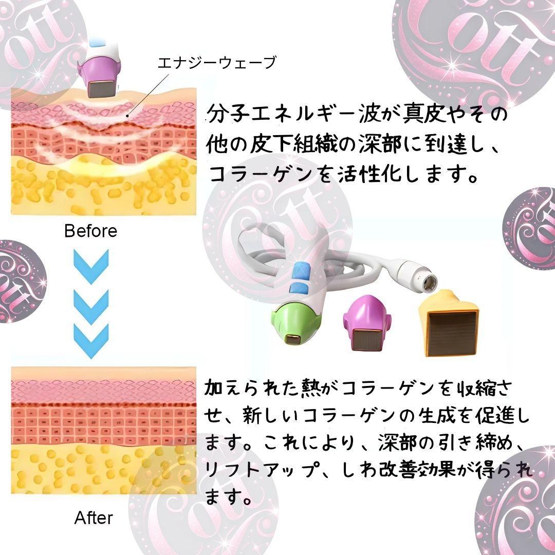 【大人気・美品】RF美顔器　まぶたもOK！たるみ・しわ・目元・ニキビ跡にも◎