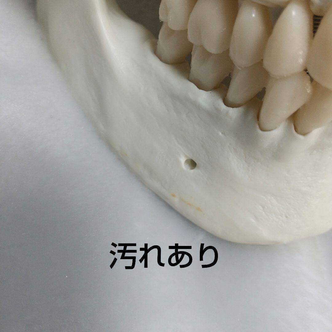 頭蓋骨　脳　模型　セット　3B Scientific Anatomy 人体解剖学