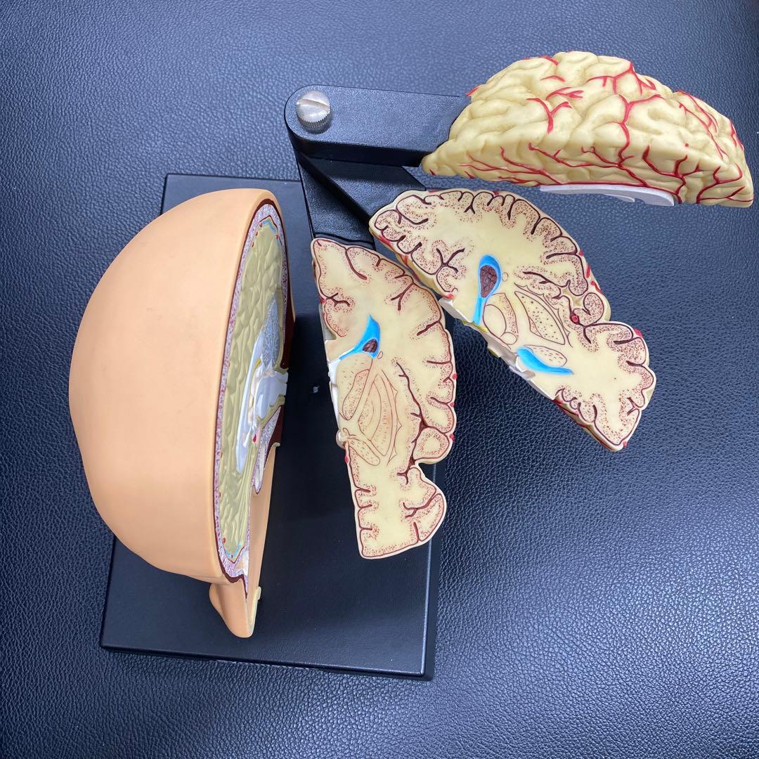 脳模型 約14cm x 20cm x14cm