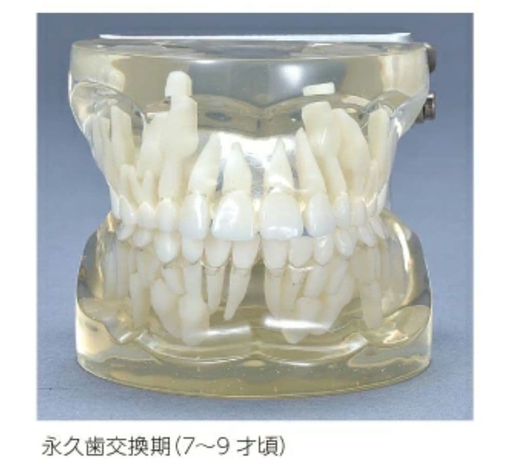 2個 歯列模型 実物大 開閉式 乳歯期 永久歯萌出前 永久歯 交換期 模型 歯科