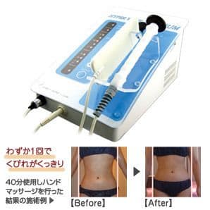 ラジオ波エステ☆ハイパーウェーブプレミアム☆痩身 たるみ 引き締め