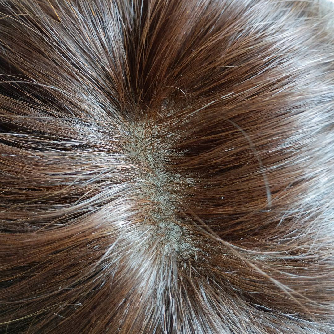 人毛mixウィッグ/ダークブラウン