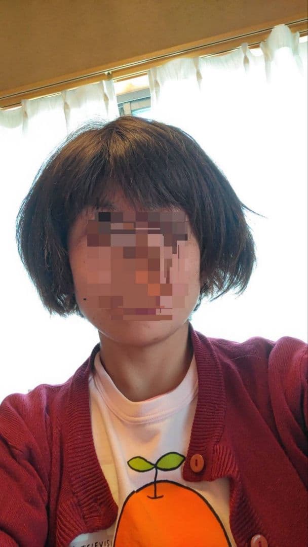 【人毛医療ウィッグ】