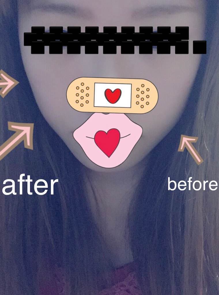 ナリス  ビューティプロソニック  ジェル＋おまけ多数セット