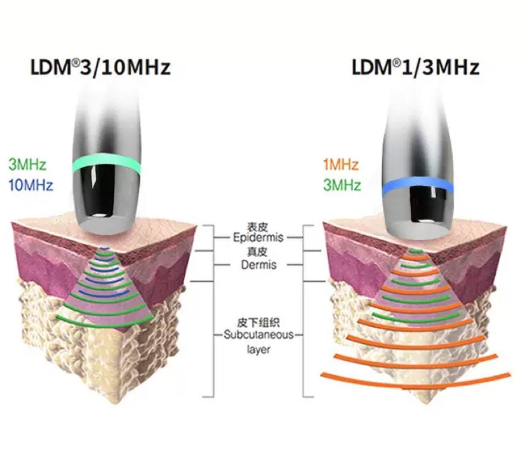 LDM水玉美容機器リフトアップマシン